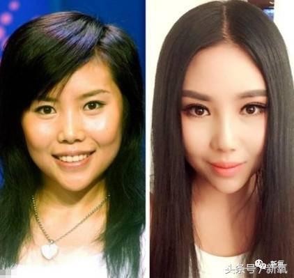 整容脸泛滥背后：明星执意“换脸”，到底在跟谁较劲？